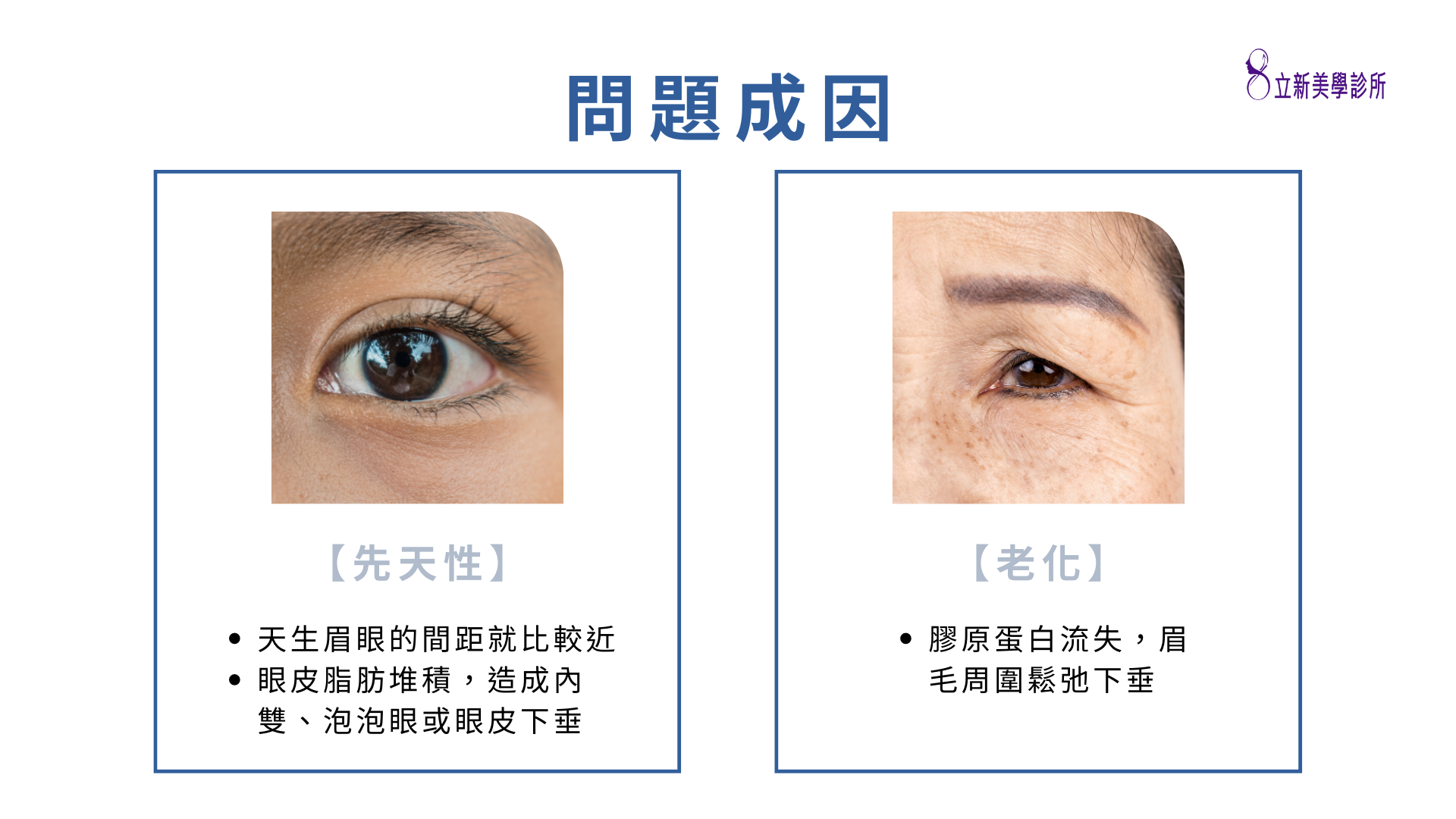 【先天性】 ·天生眉眼的間距就比較近 ·眼皮脂肪堆積,造成內 雙、泡泡眼或眼皮下垂，【老化】 ·膠原蛋白流失,眉 毛周圍鬆弛下垂
