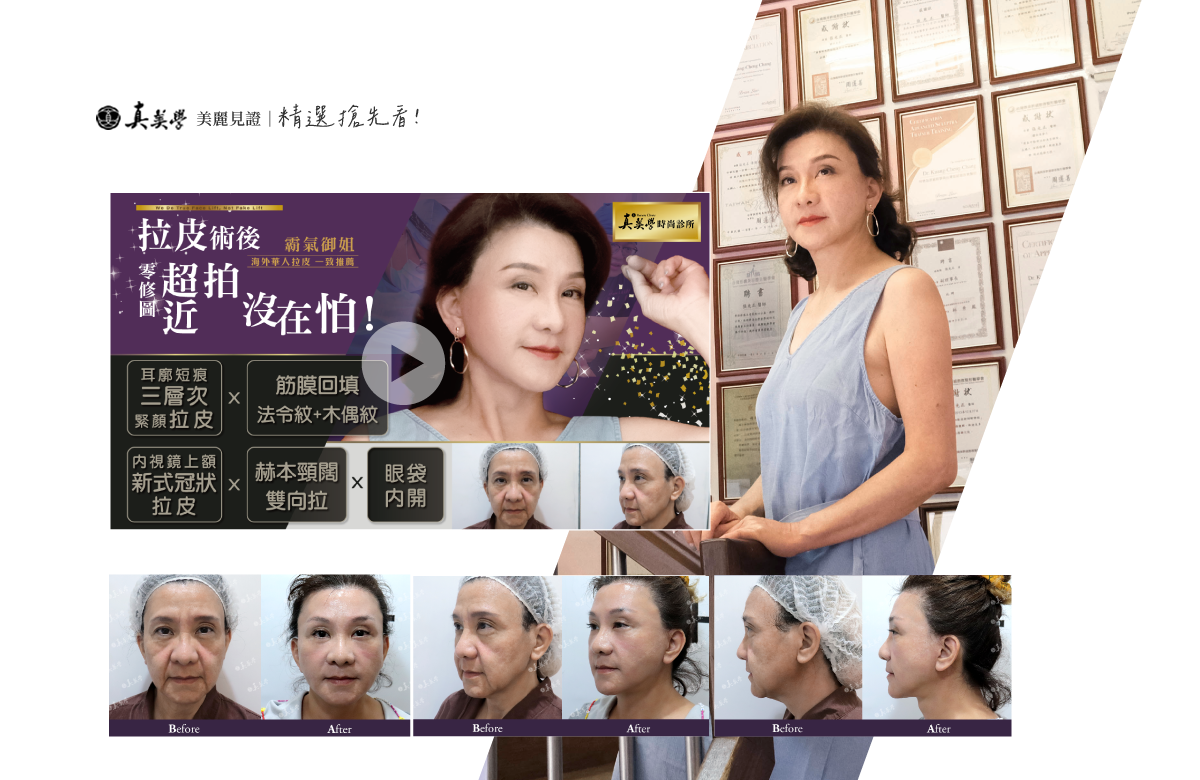 真美學美麗見證精選搶先看