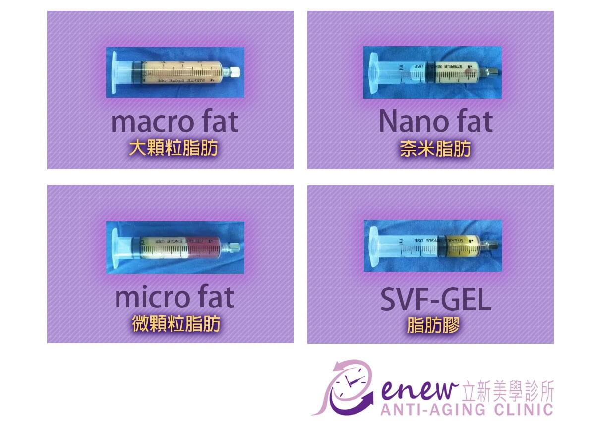 SVF-GEL被稱之為神奇的自體脂肪幹細胞膠